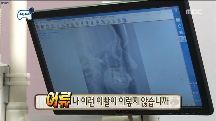[무한도전] 뼈도 못생겼구나 | 인스티즈