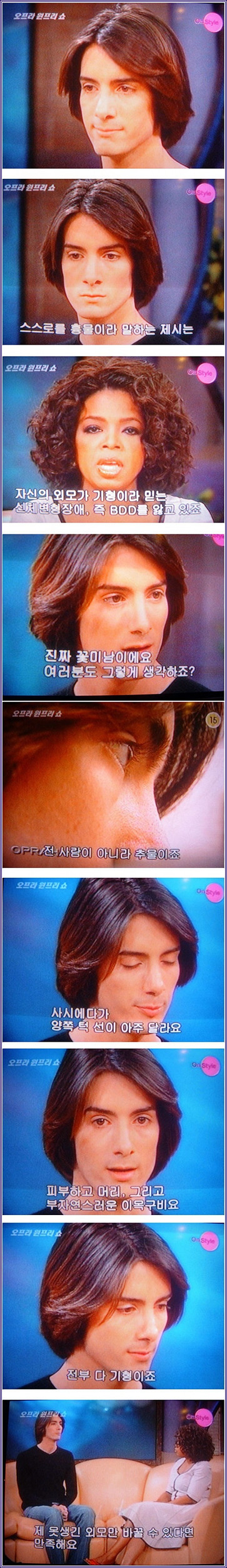 자신의 얼굴이 기형이라고 믿는 BDD 증후군 | 인스티즈
