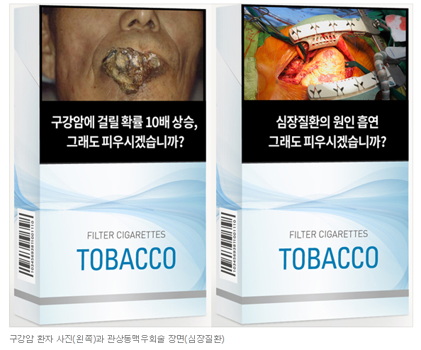 12월 23일부터 시행한 답뱃갑 경고그림 (혐오주의) | 인스티즈
