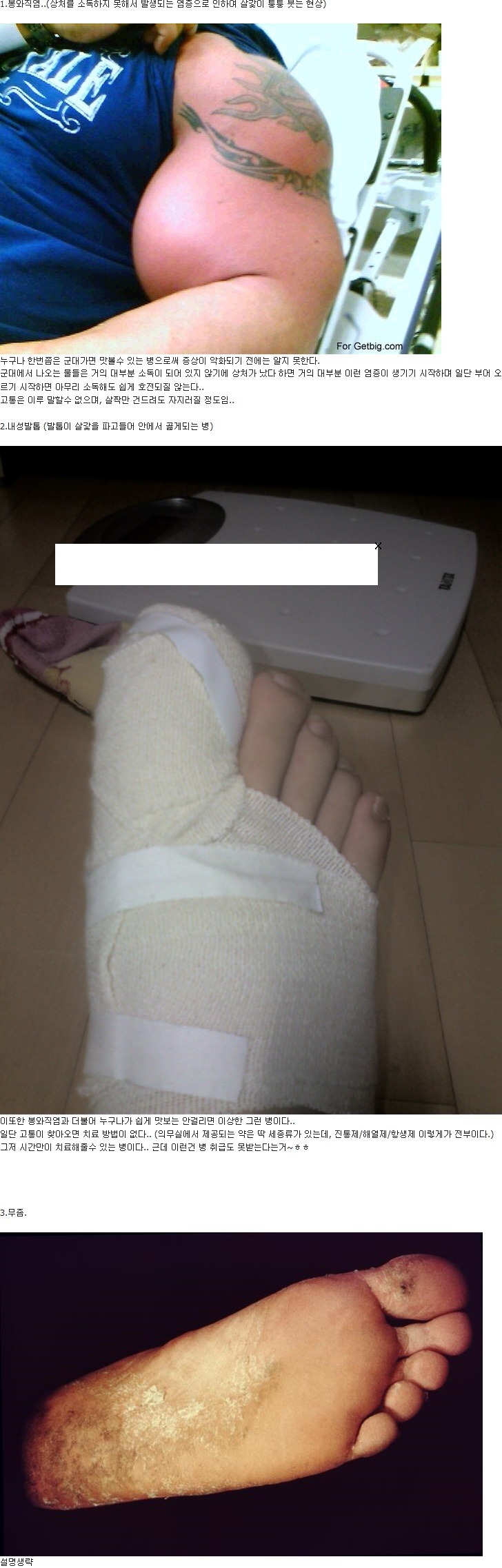 군대에서 가장 많이 걸리는 병들 | 인스티즈