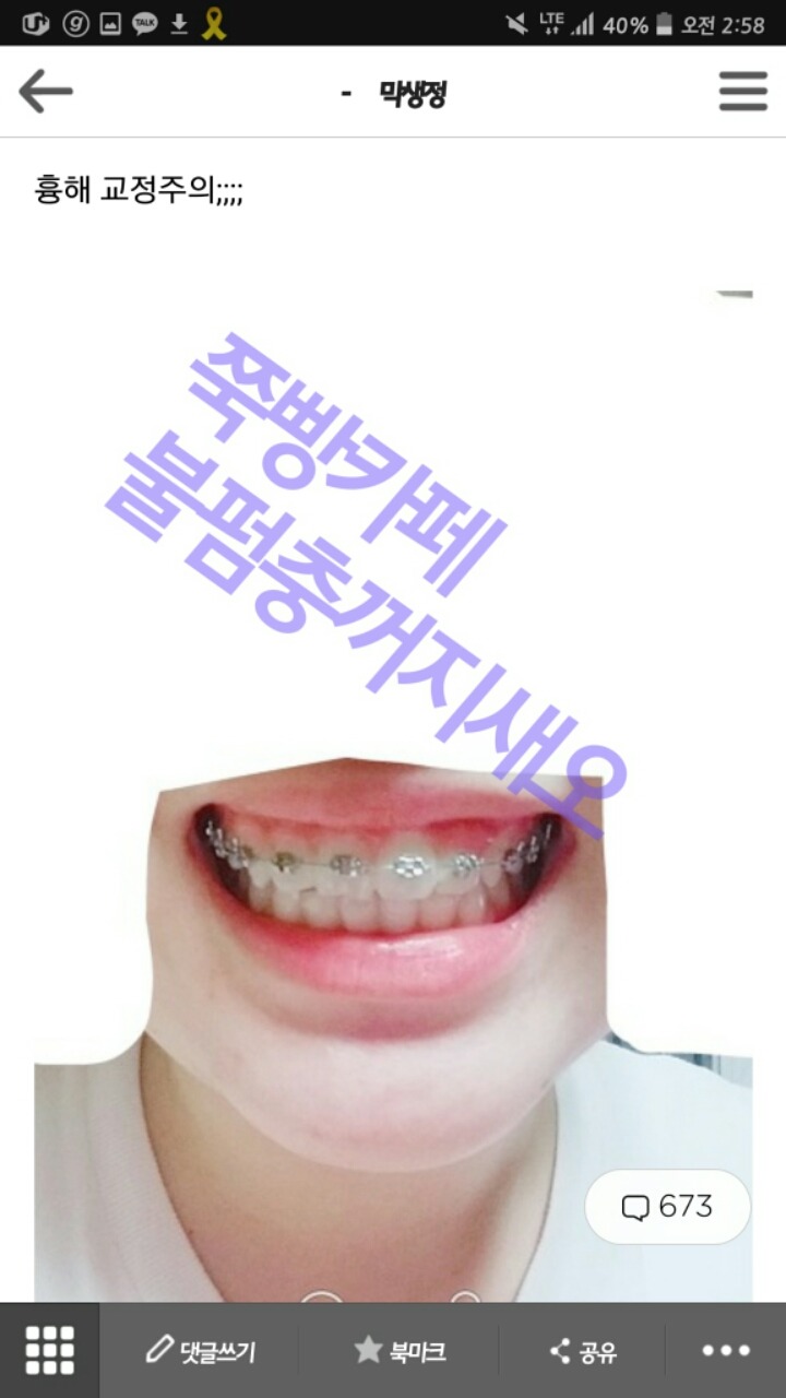 막생정에 올라온 치아에 낀 음식 확인할때 (배꼽주의) | 인스티즈