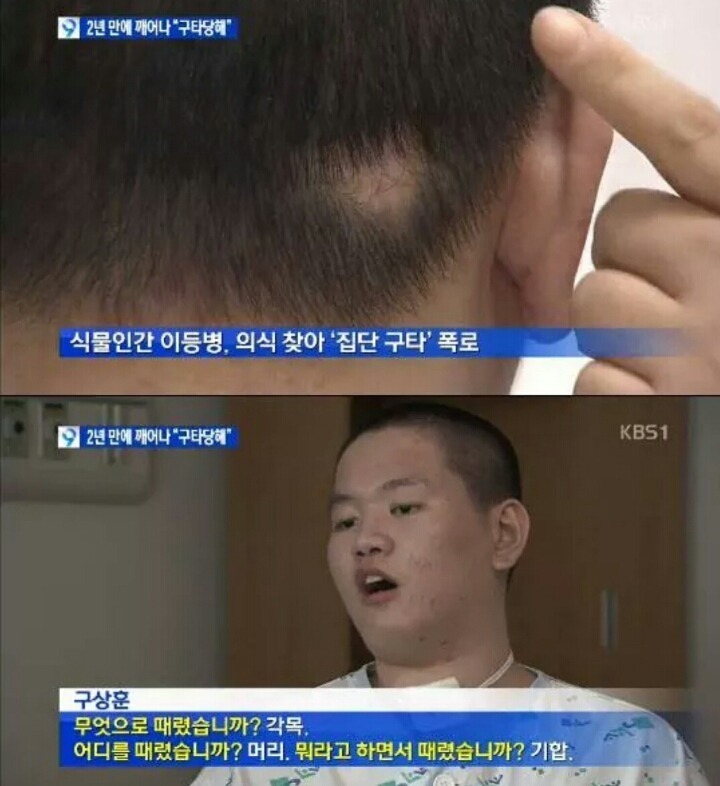 군대에서 식물인간이 된 청년이 2년만에 깨어나서 한 진술 | 인스티즈