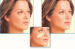 미국에서 많이하는 성형수술 세가지 | 인스티즈