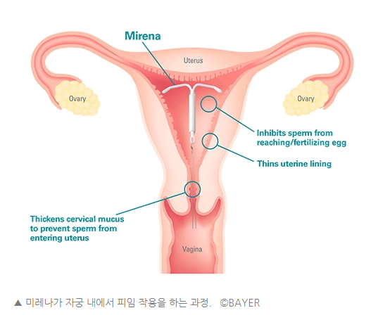 생리와 작별한 여성들 | 인스티즈