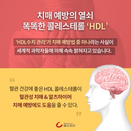 HDL 이미지