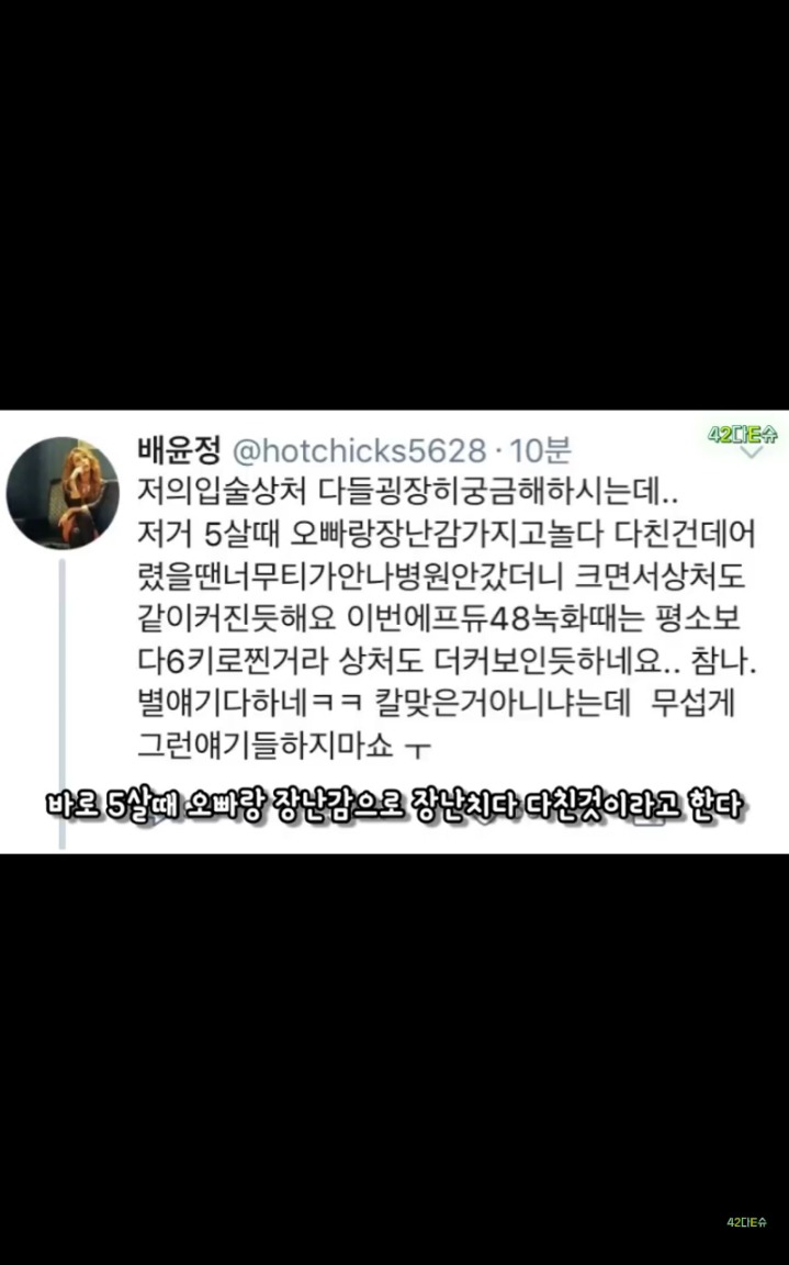 배윤정 입술에 상처 생긴 이유 | 인스티즈